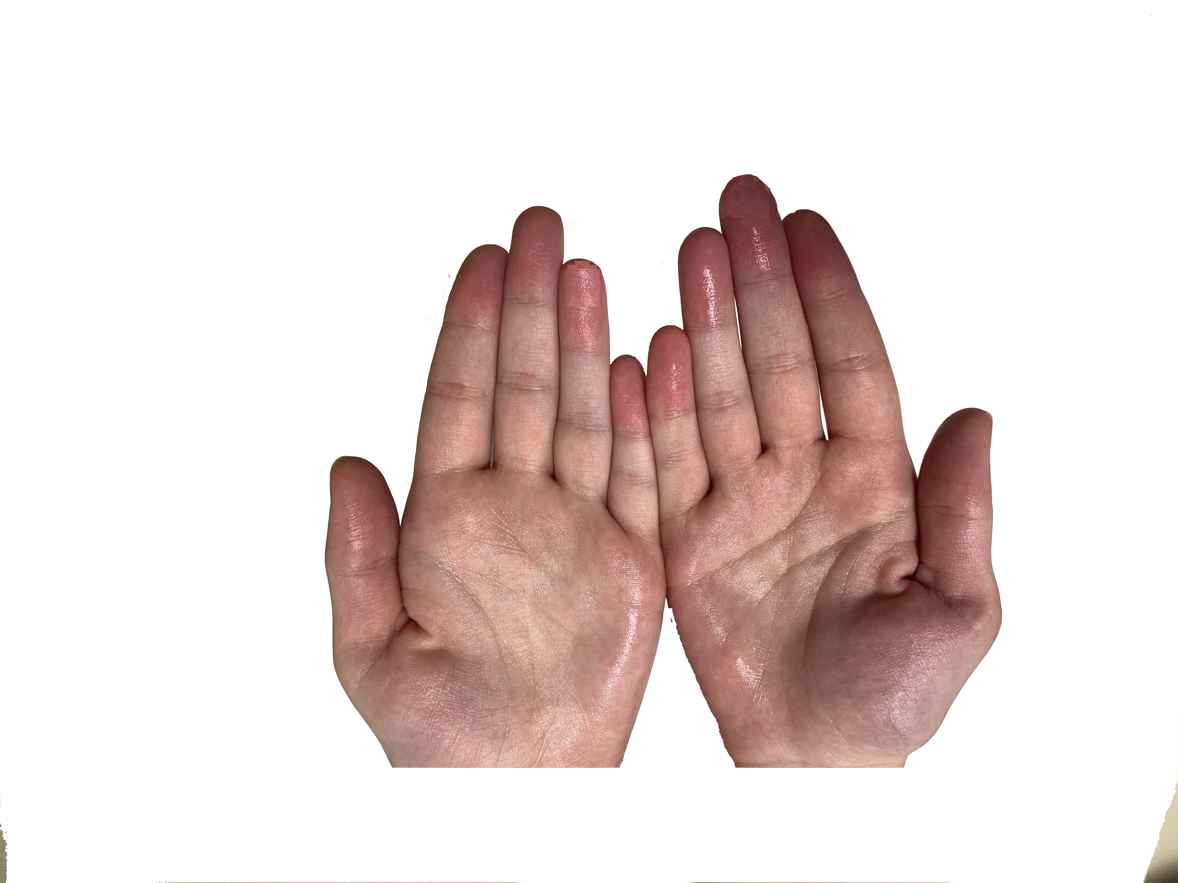 El Terlemesi